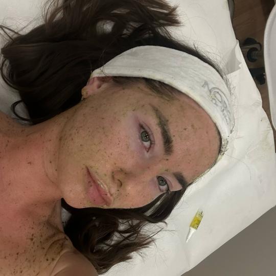 Beauty Box - Zagreb #zagreb Tretman lica Green peel tretman - energy