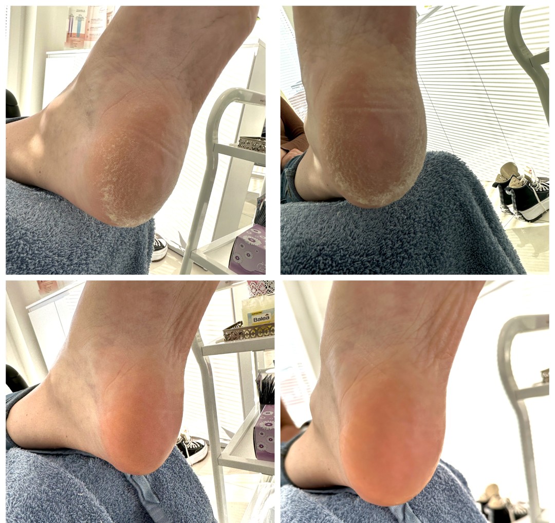 Beauty Centar Sky #zagreb Estetska pedikura Ruska pedikura