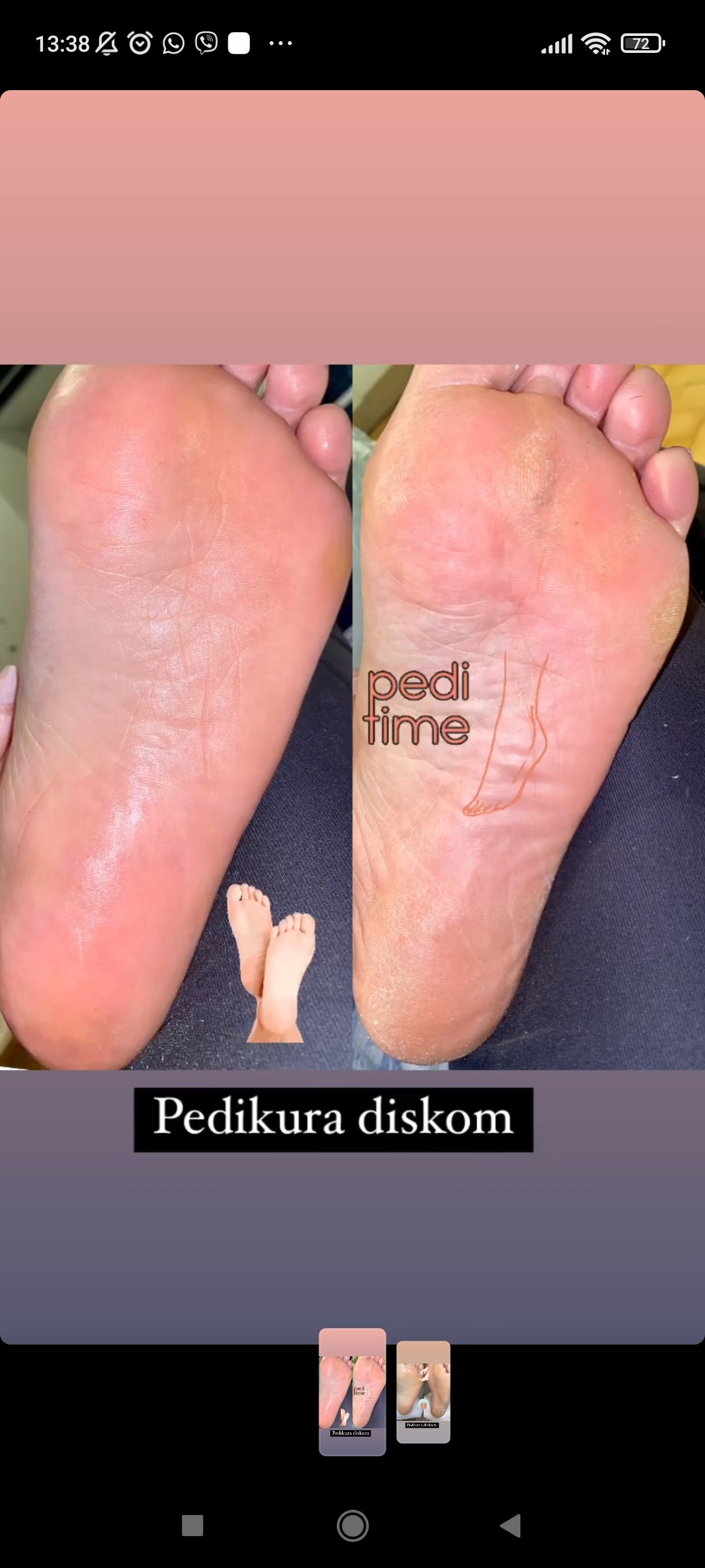 Lash and Brow studio #rogoznica Masaža teglama pedikura suha aparatna ( ruska )