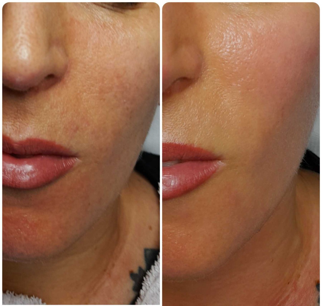 Natural #rijeka Tretman lica PRX-T33 tretman lica