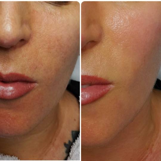 Natural #rijeka Tretman lica PRX-T33 tretman lica