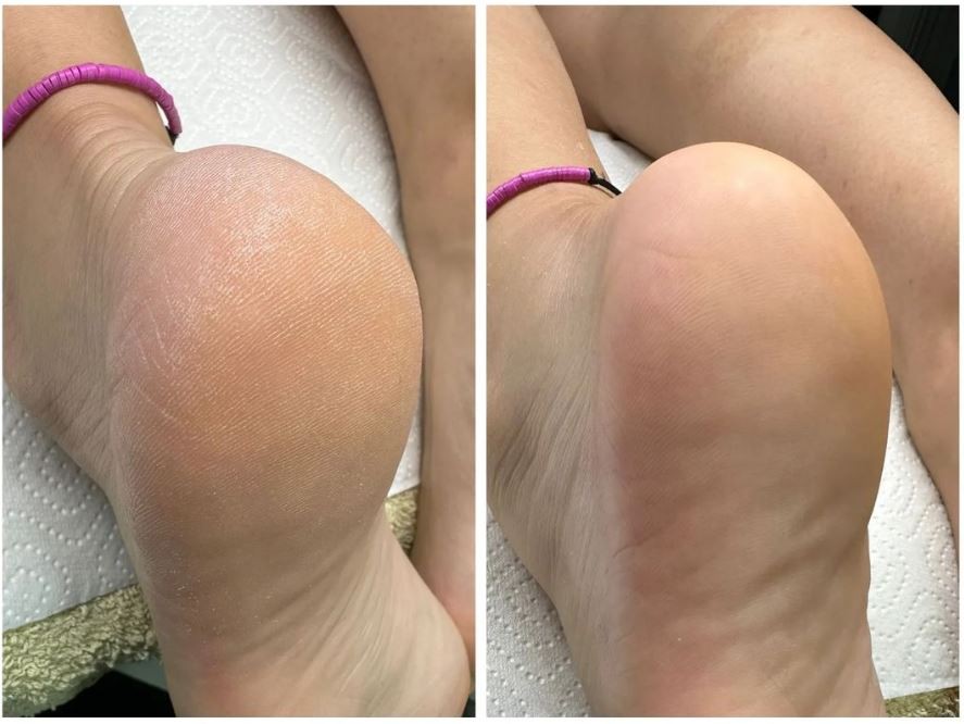 Gelaxy x Motus #zagreb Estetska pedikura Suha ruska pedikura + callux tretman