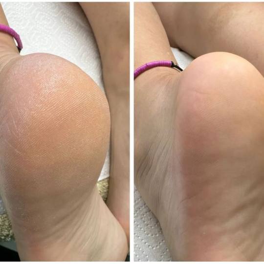 Gelaxy x Motus #zagreb Estetska pedikura Suha ruska pedikura + callux tretman