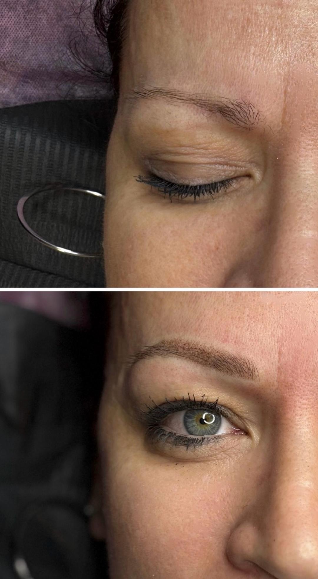 Puder obrve (sa korekcijom nakon 4-6 tjedana) - Anova Aesthetics, Zagreb Trajna šminka Lice Trajna šminka, Zagreb, Trešnjevka – jug