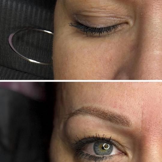 Anova Aesthetics usluga