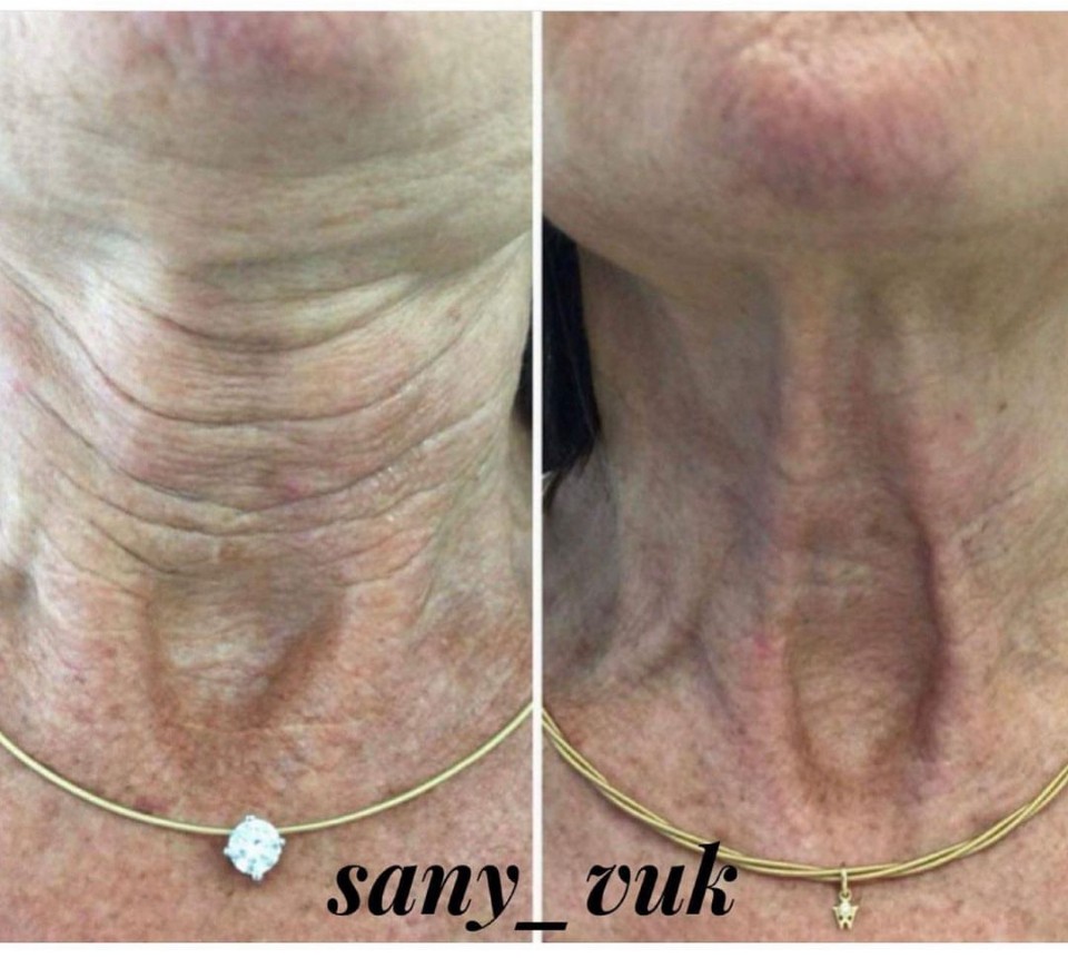 Sany Nails & Cosmetics #zagreb Tretman lica