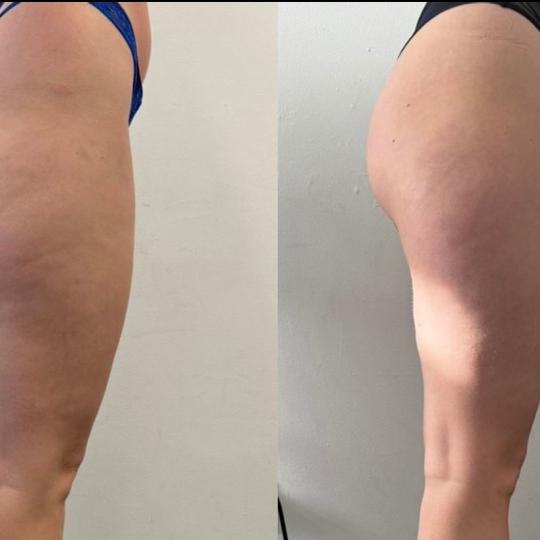 Perfect body beauty bar usluga