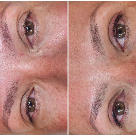 Cosmoderm & Centar Estetica usluga