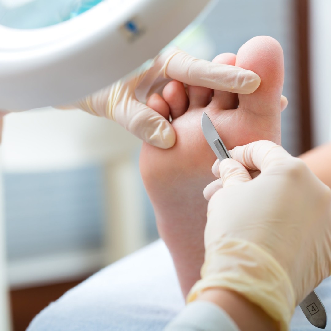 Antiage beauty room Lady Goga #zagreb Medicinska pedikura Pedikura medicinska (preko 30 min i duže)