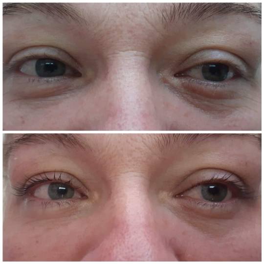 Antiage beauty room Lady Goga usluga