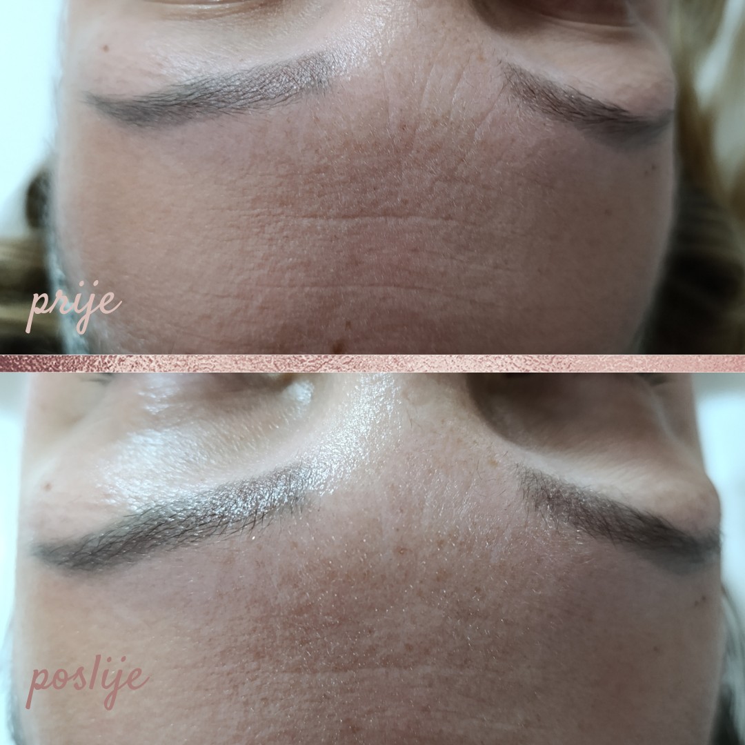 In Statera #zagreb Masaža lica Deep lifting masaža lica + tretman radiofrekvencijom