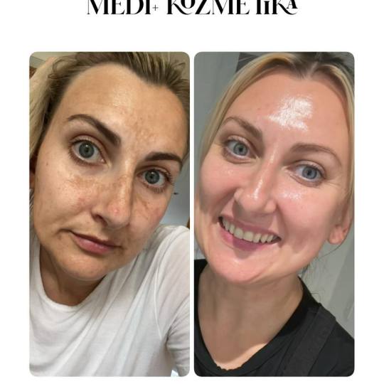 Una Victoria beauty concept usluga