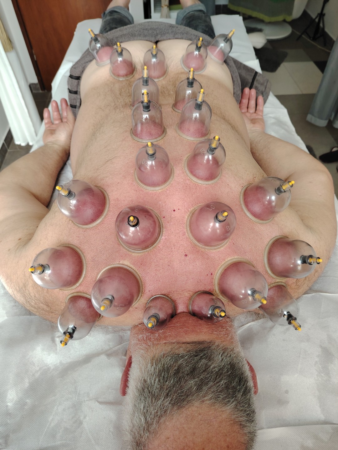 Nirvana Life Therapy #zagreb Masaža leđa Kombinacija masaže leđa, cupping terapije i masaže stopala AKCIJA!!!