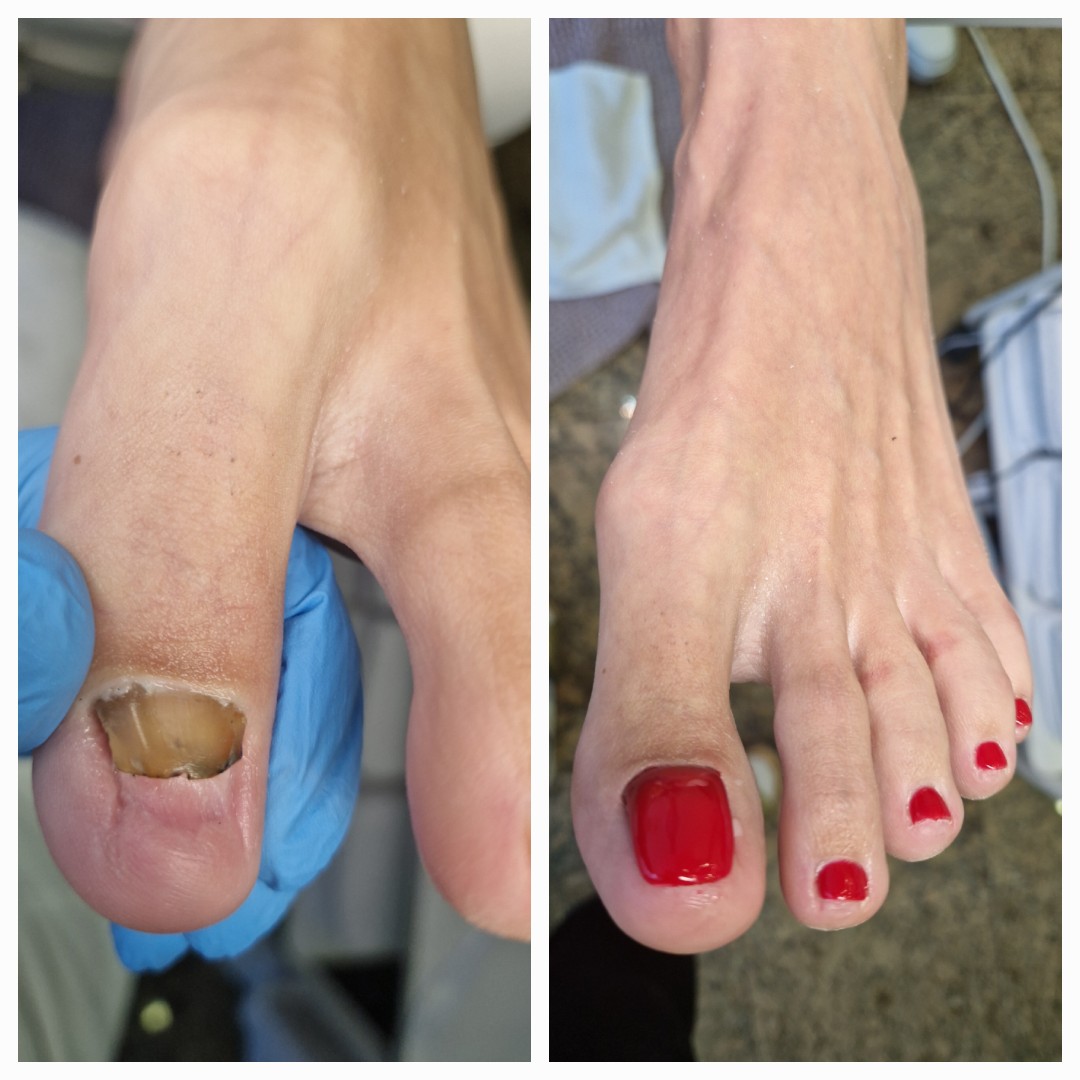 Maja #zagreb Medicinska pedikura Pedikura i trajni lak