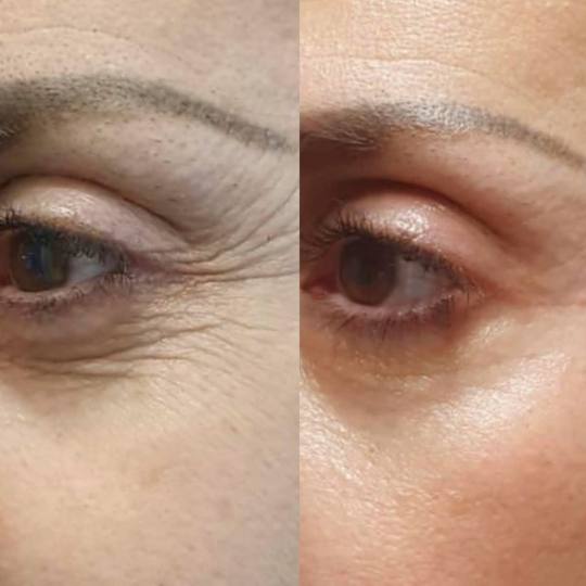 Spellar - Križ usluga