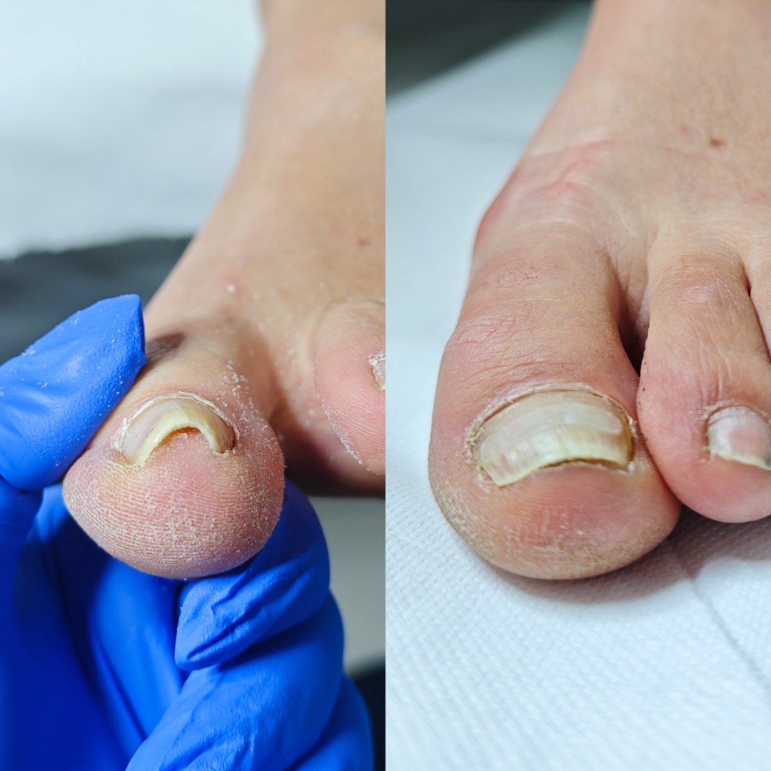 Roya Beauty & Hair Studio #dugo-selo Medicinska pedikura Medicinska pedikura