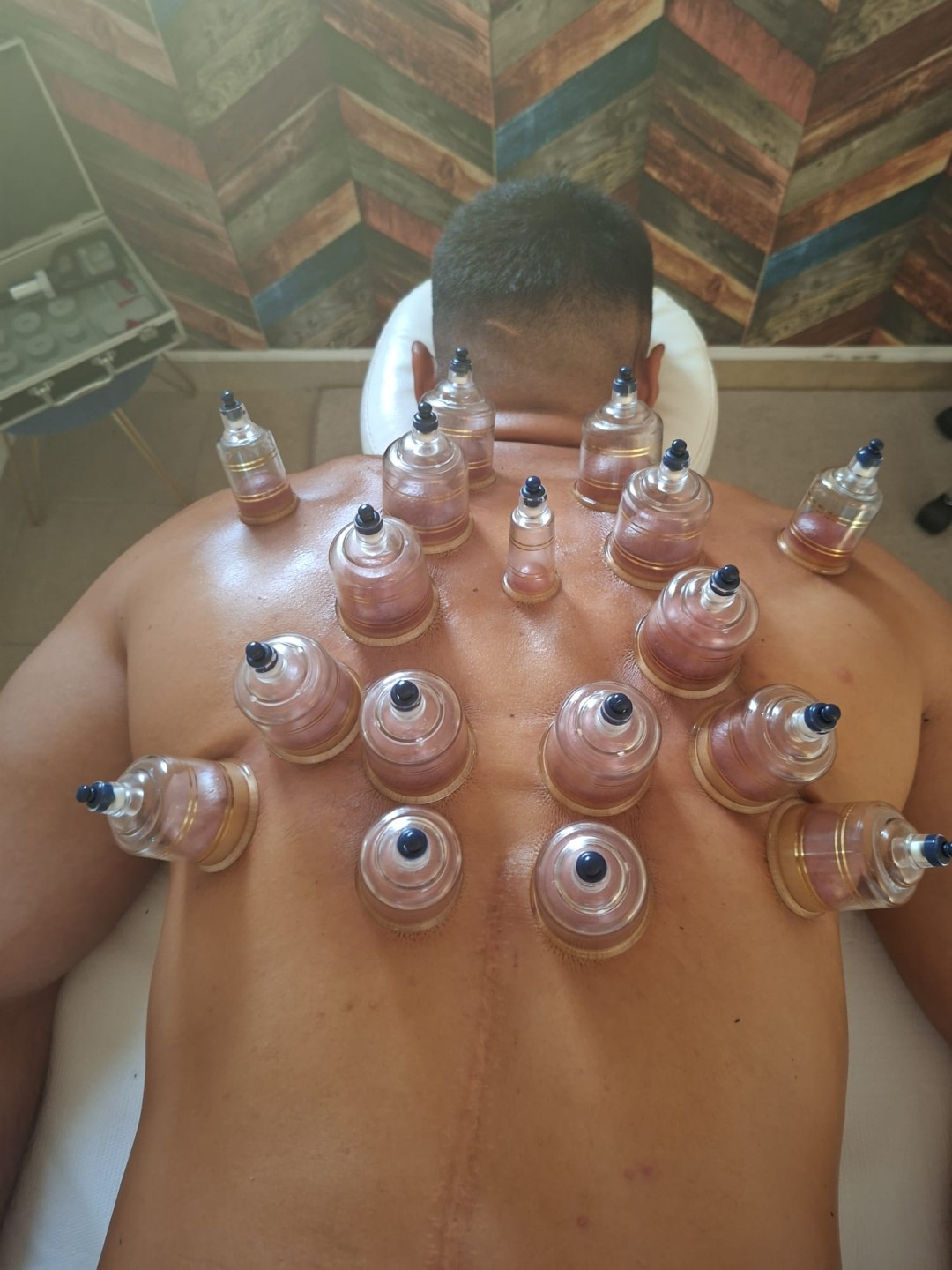 S M Beauty Bloom #zadar Opća masaža Cupping masaža