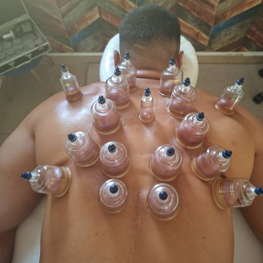 S M Beauty Bloom #zadar Opća masaža Cupping masaža