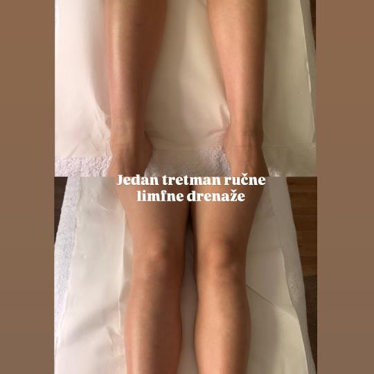 KK Body Therapy #zagreb Tretmani tijela Ručna limfna drenaža