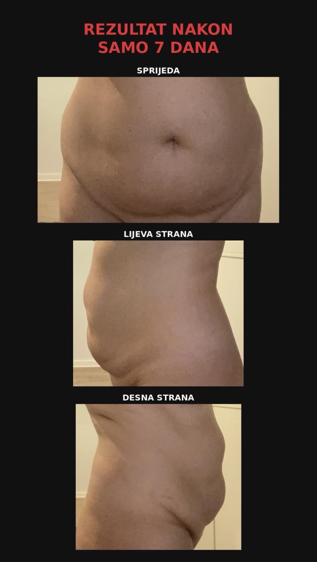 Perfect body beauty bar #zagreb Body wrap / pakovanja Deluxe shape ultrazvučna kavitacija - 60 minuta