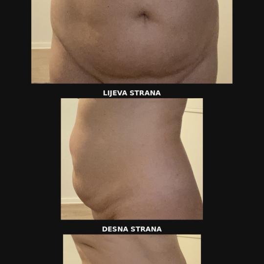 Perfect body beauty bar #zagreb Body wrap / pakovanja Deluxe shape ultrazvučna kavitacija - 60 minu