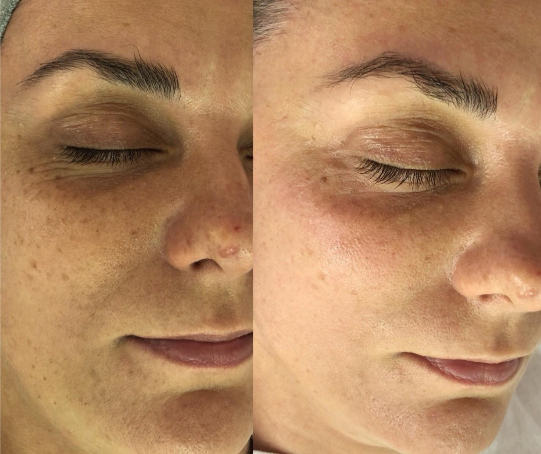 Antiage beauty room Lady Goga #zagreb Tretman lica