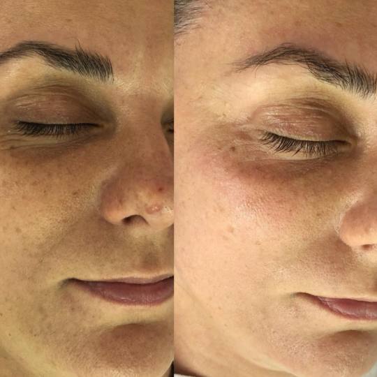 Antiage beauty room Lady Goga #zagreb Tretman lica