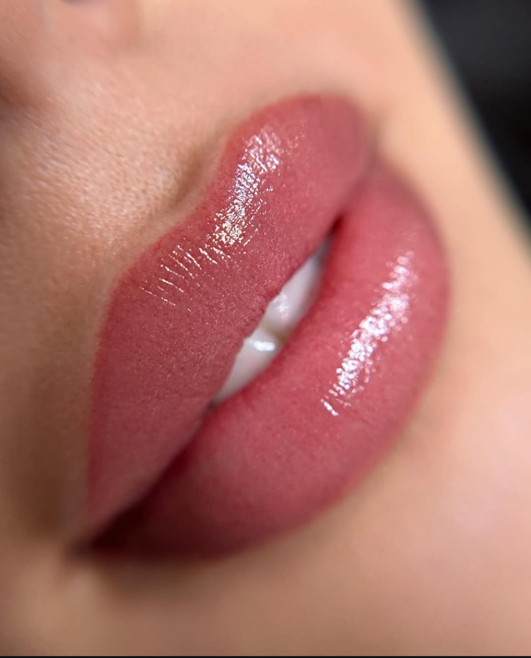 Glam Lab #zagreb Laserska epilacija Nanopigmentacija usana