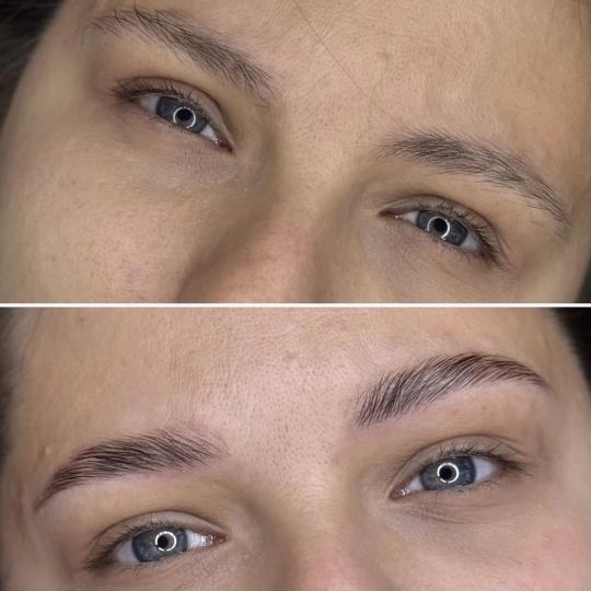 Anova Aesthetics usluga