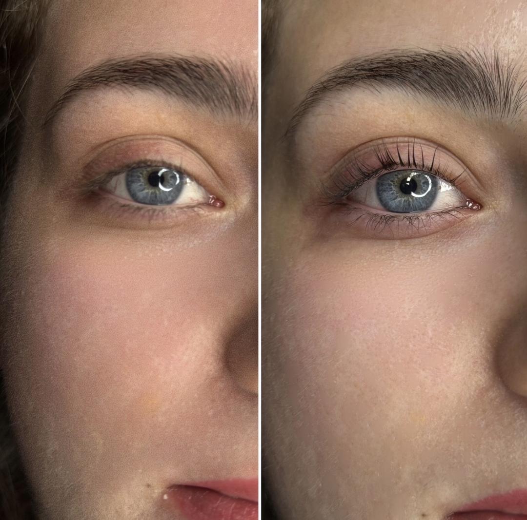 Anova Aesthetics #zagreb Trepavice Korejski lash lift + bojanje trepavica + aftercare set