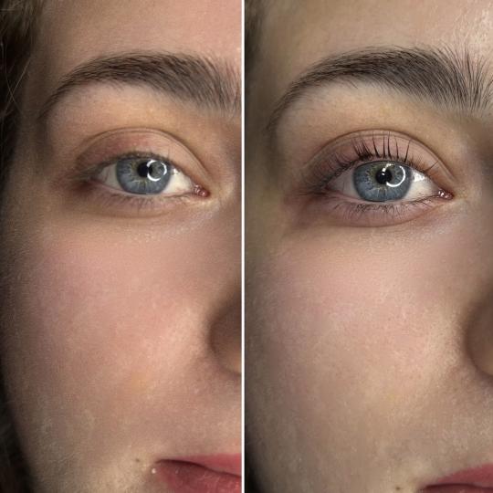 Anova Aesthetics #zagreb Trepavice Korejski lash lift + bojanje trepavica + aftercare set Lice