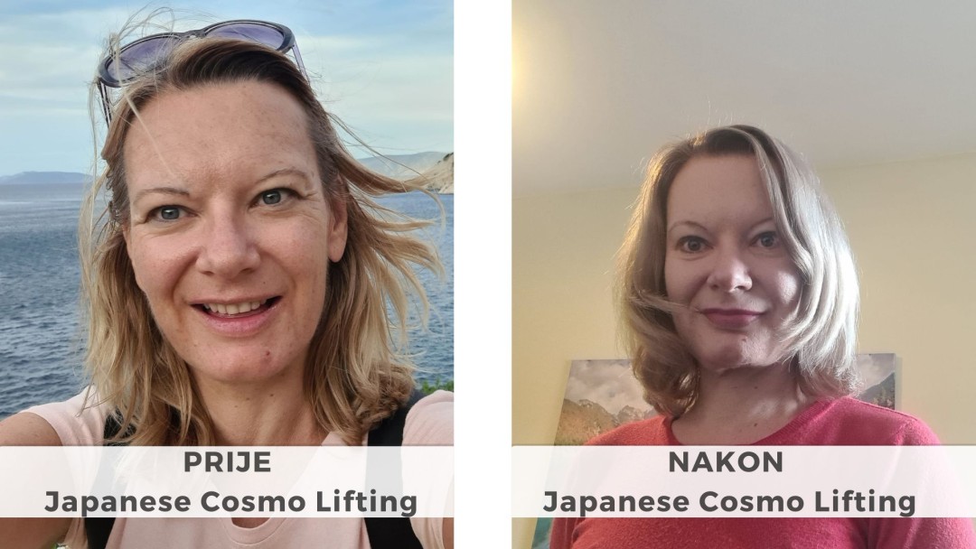 Japanese Cosmo Lifting lica - 60 minuta - InSpiriter, Zagreb Lifting / zatezanje kože Lice Lifting / zatezanje kože, Zagreb, Donji grad - Centar