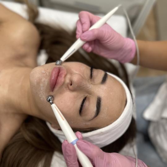 Beauty Box - Zagreb #zagreb Tretman lica Mikrostruje lica