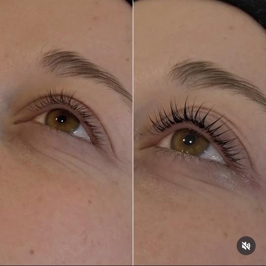 Superior Sensum usluga