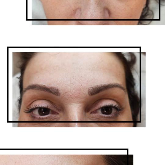 Cosmoderm & Centar Estetica usluga