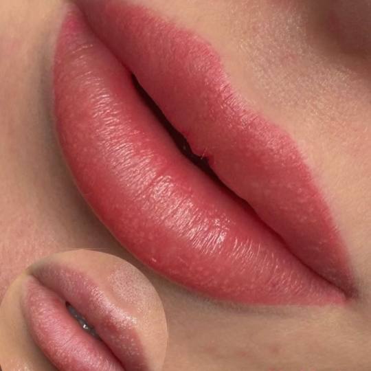 MOELL beauty #zagreb Trajna šminka Mikropigmentacija usana /Lip blush