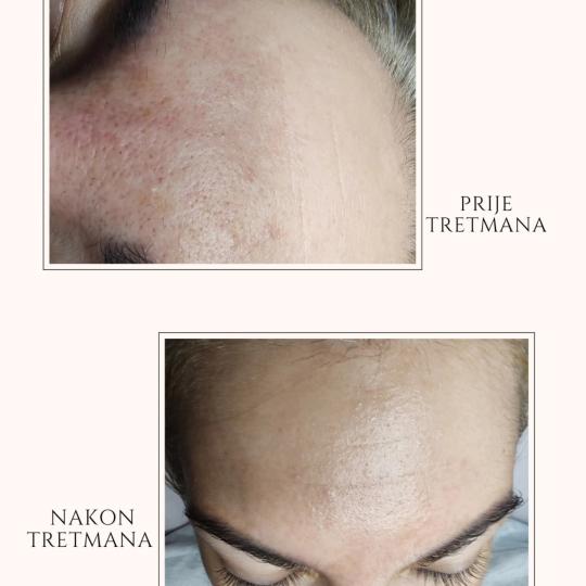 Valena estetica usluga