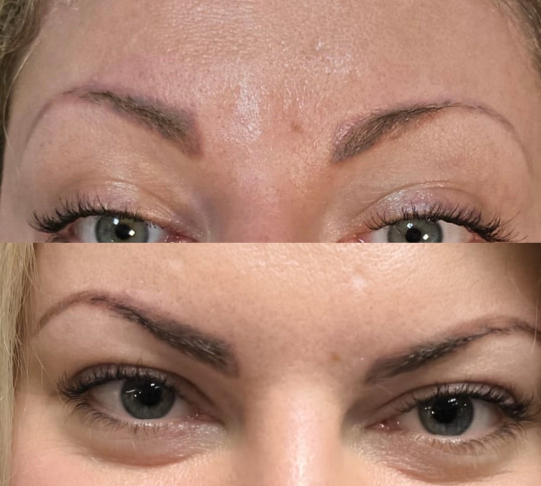 UHD OBRVE - Mare, Zagreb Obrve Lice Obrve, Zagreb, Trešnjevka – sjever