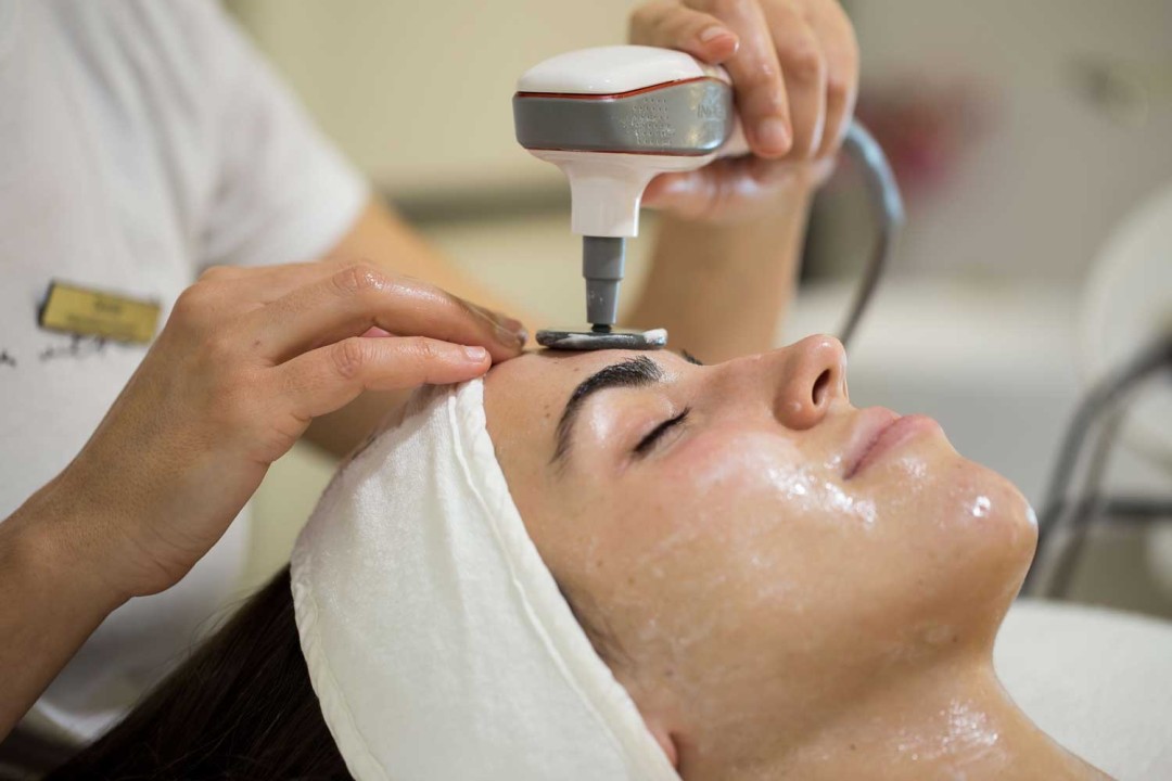 INDIBA Face lifting - Loéll Clinic, Zagreb Tretman lica Lice Tretman lica, Zagreb, Maksimir