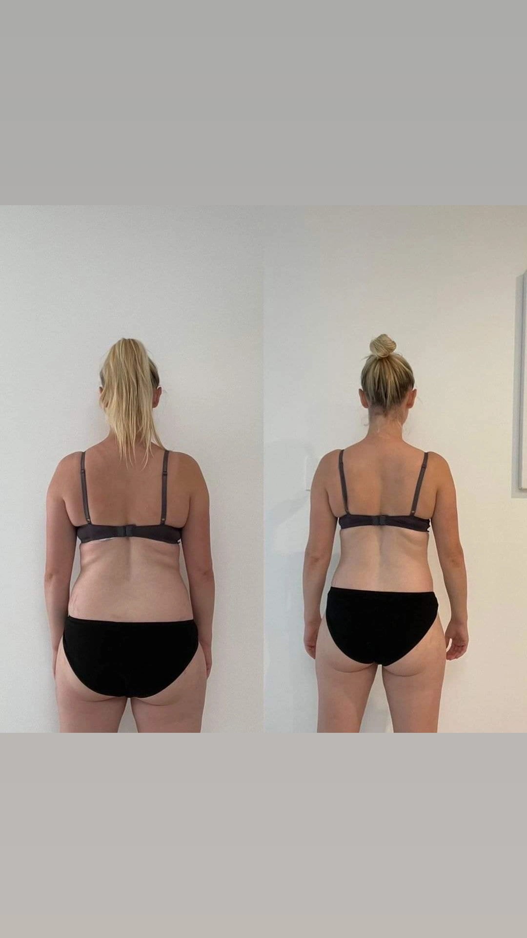 Antiage beauty room Lady Goga #zagreb Anticelulit masaža