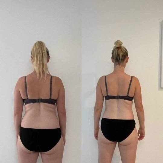 Antiage beauty room Lady Goga #zagreb Anticelulit masaža