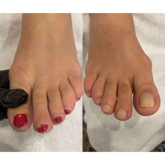 Re'belle skincare usluga