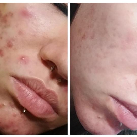 Cosmoderm & Centar Estetica usluga