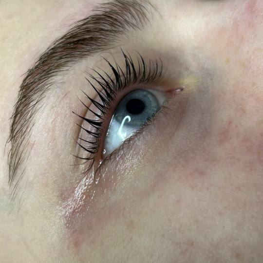 Glow Differently usluga