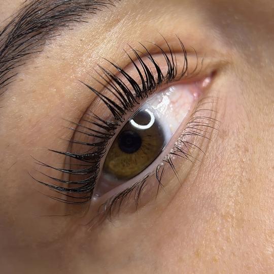 Théa Beauty Spot usluga