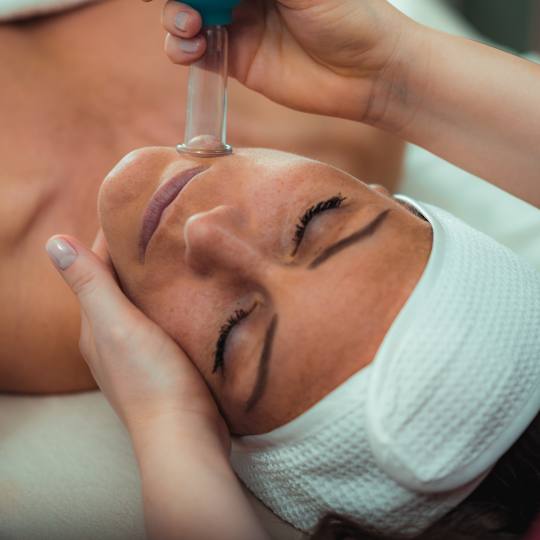 Aromavita Bella Donna #varazdin Tretman lica Cupping lica + njega lica Cupping lica je tretman masa