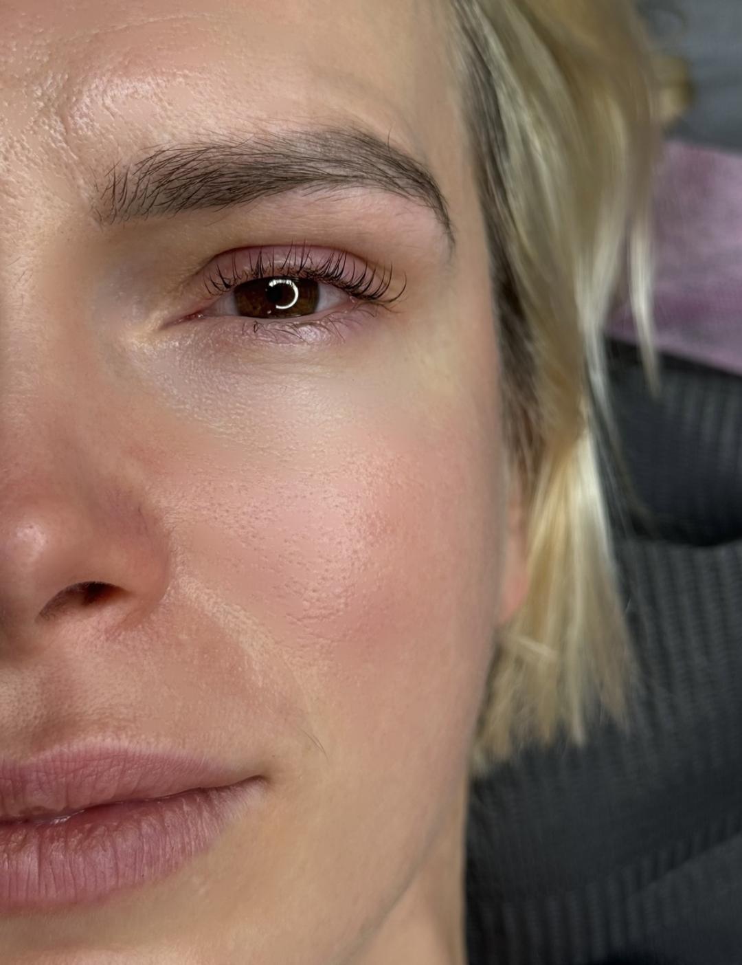 Lash lift + bojanje trepavica - Anova Aesthetics, Zagreb Trepavice Lice Trepavice, Zagreb, Trešnjevka – jug