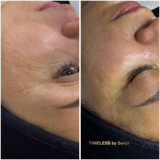 Timeless by Sanja usluga