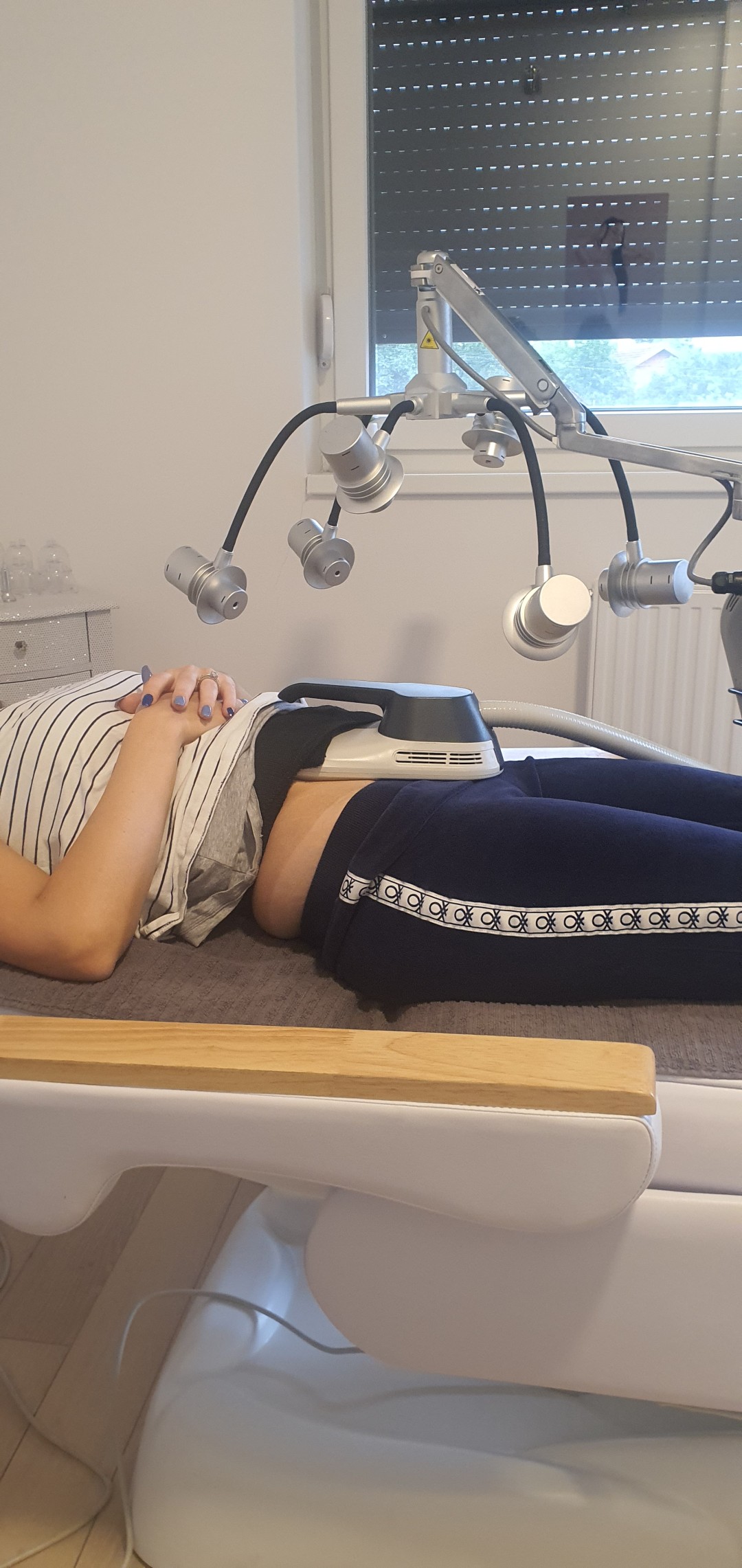 SOLO Beauty Centar #zagreb Tretmani tijela EMSZero 4 aplikatora -2 zone - 30 minuta