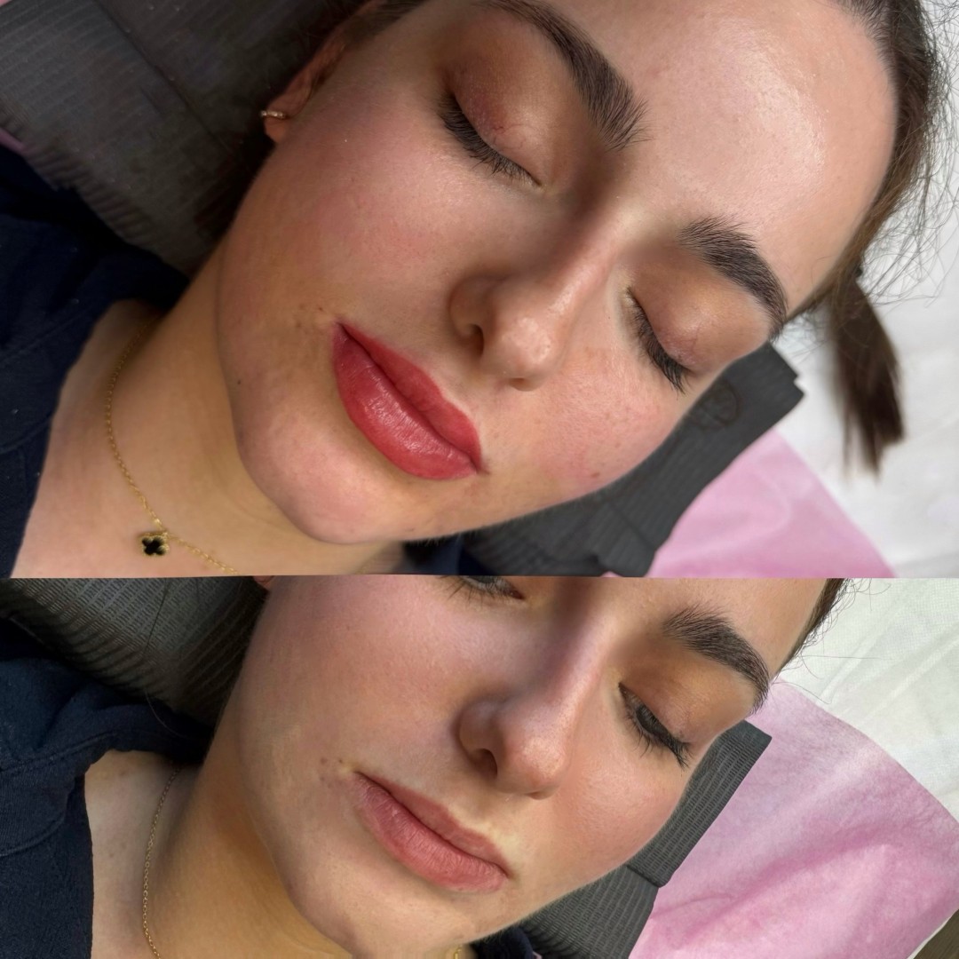 Anova Aesthetics #zagreb Trajna šminka Trajna šminka - usne